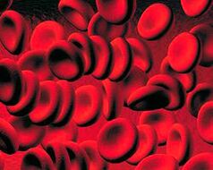 Colección de cuerpos de cetonas en la sangre de la diabetes